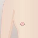 乳腺切除＋脂肪吸引＋レヌビオン の手順 縫合