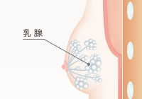 真性女性化乳房の原因