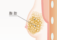 偽性女性化乳房の原因