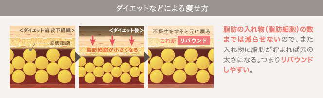 ダイエットなどによる痩せ方: 脂肪の入れ物（脂肪細胞）の数までは減らせないので、また入れ物に脂肪が貯まれば元の太さになる。つまりリバウンドしやすい。