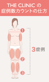 THE CLINIC の症例数カウントの仕方