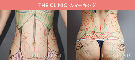 THE CLINIC のマーキング