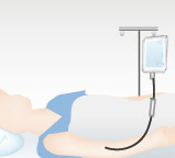 当院の麻酔(静脈麻酔)