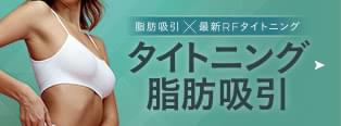 二重顎の解消、二の腕痩せを叶える! タイトニング脂肪吸引モニター募集