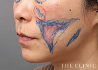 解剖学に基づいたデザイン