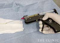 マフトガン使用で“しこりリスク”を更に軽減