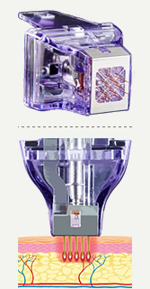 ​​PRIME