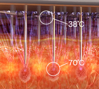 広範囲へ最適なエネルギー供給で強力タイトニング