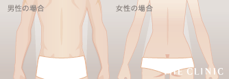 腰の脂肪吸引 男女のデザインイメージ