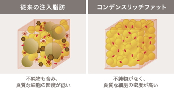 従来の注入脂肪とコンデンスリッチファットの品質比較図