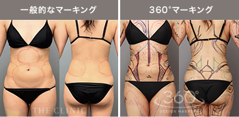 一般的なマーキングと360°マーキングの比較写真