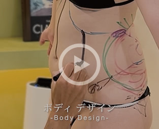 エンブレイス×脂肪吸引 体験談動画2