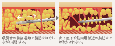 吸引プロセス