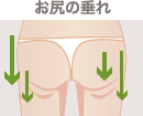 お尻の垂れ