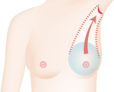 脇から取るメリット