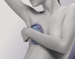 THE CLINIC(ザクリニック) のシリコンバッグ除去とは?