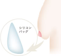 除去後の再生にも対応