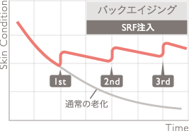バックエイジング
