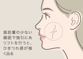 脂肪量の少ない顔面で強引に糸リフトを行うと、ひきつれ感が強く出る
