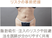 リスクの事前把握