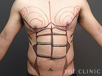 女性らしさを意識した綿密なマーキング