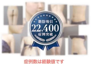 症例数は経験値です