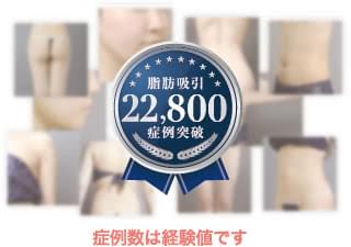 症例数は経験値です