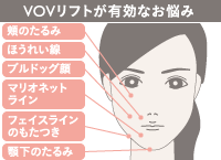 VOVリフトが有効なお悩み：頬のたるみ／ほうれい線／ブルドッグ顔／マリオネットライン／フェイスラインのもたつき／顎下のたるみ
