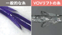 一般的な糸とVOVリフトの糸