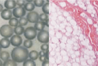 PCL分解の光学顕微鏡画像（左）と投与２週間後のウサギの組織像（右）