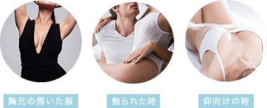 豊胸の仕上がりでバレやすい場面（胸元の開いた服、触られた時、仰向けの時）