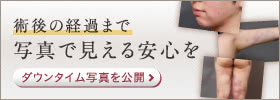 術後の経過まで写真で見える安心を ダウンタイム写真を公開