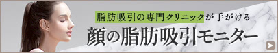 顔の脂肪吸引の特別モニター募集