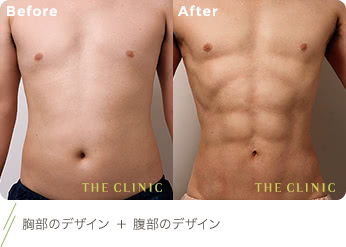 胸部のデザイン ＋ 腹部のデザイン