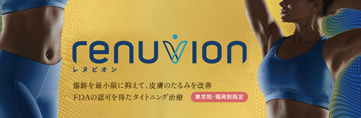 レヌビオンについて
