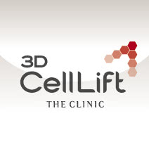 3Dセルリフト(切らないフェイスリフト)の施術