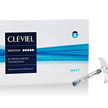 クレヴィエル(鼻・顎のヒアルロン酸注入)の施術