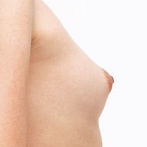 乳頭の調整の施術