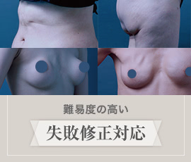 難易度の高い失敗修正対応