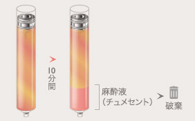 10分間 | 麻酔液（チュメセント）破棄