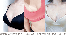 ※実際に当院でナチュラルバストを受けられたゲストの方々