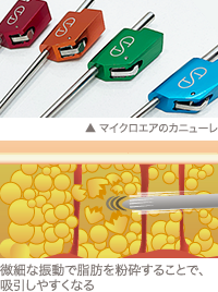 マイクロエア