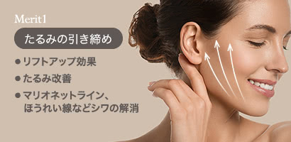 Merit1 たるみの引き締め: ● リフトアップ効果 ● たるみ改善 ● マリオネットライン、ほうれい線などシワの解消
