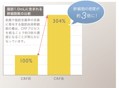 肌質や脂肪定着率の改善に寄与する脂肪由来幹細胞の量は、凍結→解凍のプロセスを経ることで約３倍になることが明らかになっています。