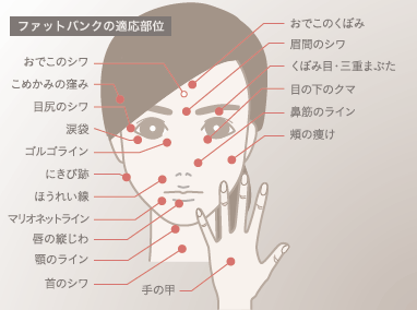 適応部位