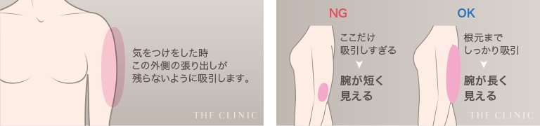 外側の張り出しと付け根部分をしっかり吸引する
