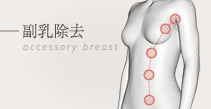 副乳