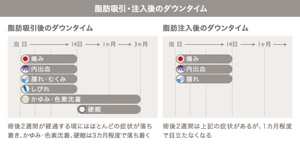 脂肪吸引、脂肪注入後のダウンタイム
