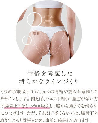 骨格を考慮した滑らかなラインづくり | くびれ脂肪吸引では、元々の骨格や筋肉を意識してデザインします。 例えば、ウエスト周りに脂肪が多い方は腸骨上下をしっかり吸引し、脇から腰までを滑らかにつなげます。ただ、それほど多くない方は、腸骨下を取りすぎると骨張るため、事前に確認しておきます。