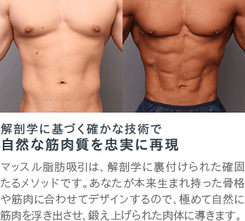解剖学に基づく確かな技術で 自然な筋肉質を忠実に再現 | マッスル脂肪吸引は、解剖学に裏付けられた確固たるメソッドです。あなたが本来生まれ持った骨格や筋肉に合わせてデザインするので、極めて自然に筋肉を浮き出させ、鍛え上げられた肉体に導きます。